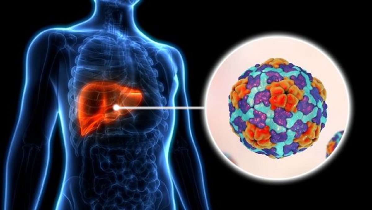 Surto de Hepatite A em Curitiba saúde confirma novo transplante em decorrência da doença